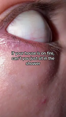 😳😳
