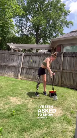 It’s a glamorous life I lead. #amputeelife #abovekneeamputee #everydaylife #boneanchoredprosthesis #integrum #opraimplantsystem #osseointegration #pooperscooper #nasty #glamorous 