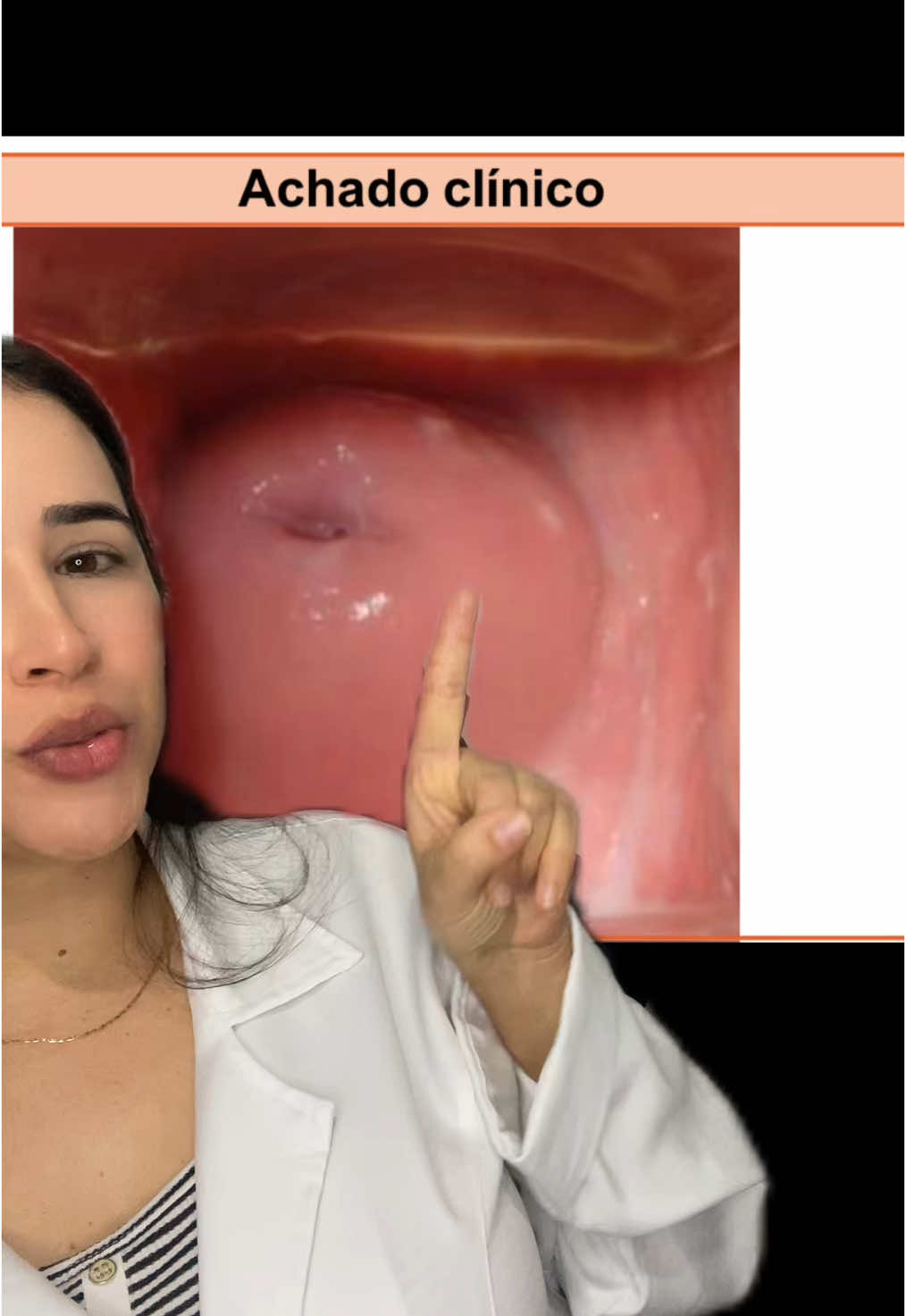 Vamos conhecer o colo do útero comigo??  . #candidiase #utero 