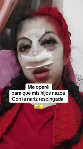 Si soy 😞🤣😂 #humor #nariz #rinoplastia 