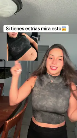 Pon atencion si eres mujer 😱👀 #mujeres #esposa #pregnant🤰 #mamaprimeriza #estrias #tiktokshop 