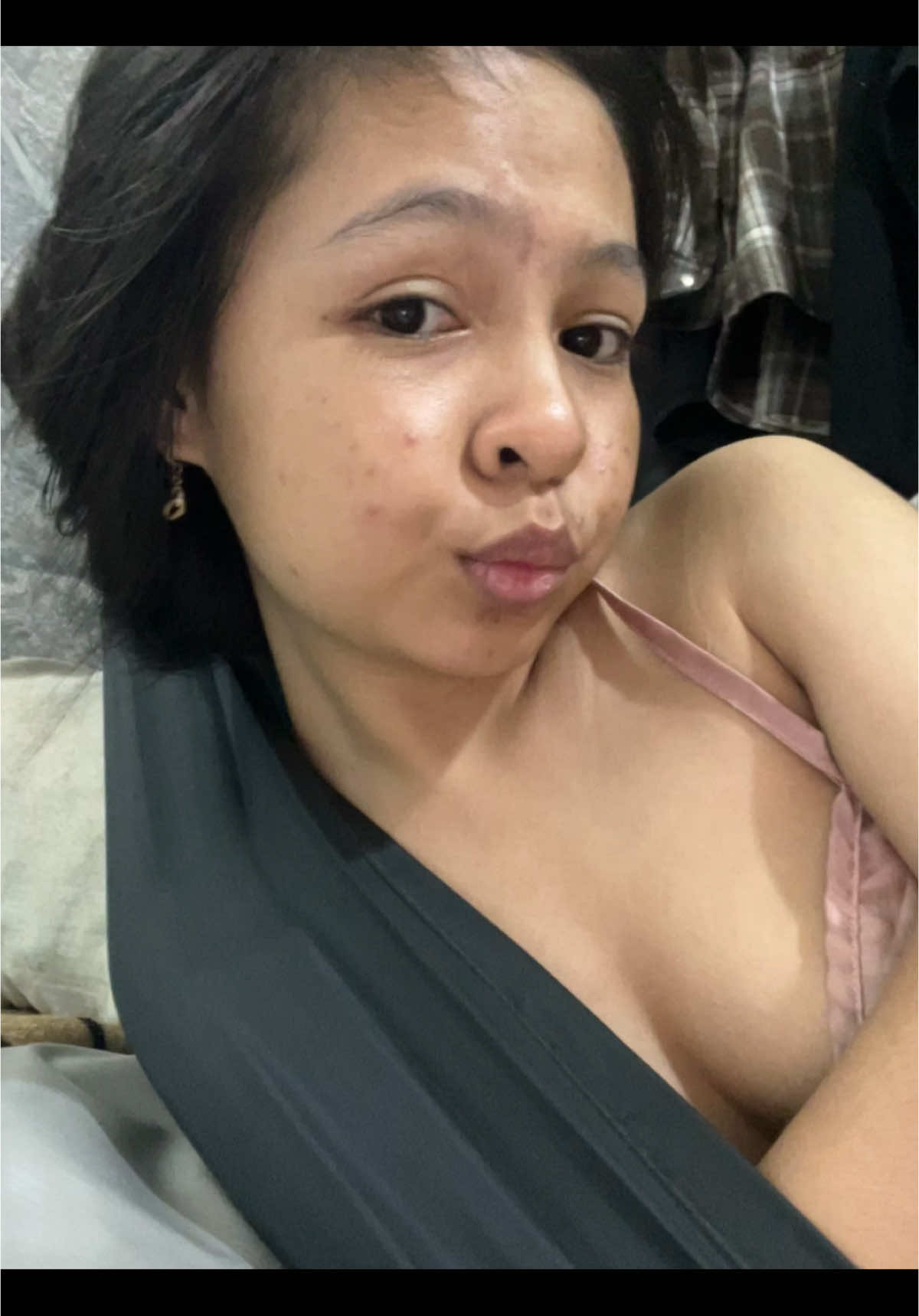 mặt mọc mụn mãi thoai 😌