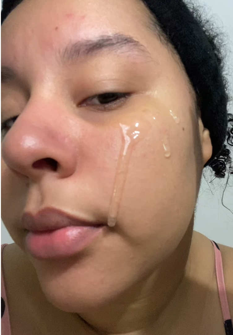 What to do before when your skin is a little bit sensitive 👇 1. Double cleansing with gentle products 😌 2. Apply thermal wather, will help you with redness and irritation, I love this one from @Eau Thermale Avène 🥰 3. Apply a toner that makes your skin feel fresher, this one, the Galacto Pore O2 by @samu_official have active oxígen bubbles, and is made with galactomyces, make my pores clean and minimize their appearance.💖 4. Always cream, I’m falling in love with this one made with PDRN by @Ulooin 💕🧡 What you do when your skin is more sensitive as usual? Read you in the comments 🥰 #riceyeasttoner #ricetoner #poros #poreserum #sebum #samu #galactomyces #glassskin #cloggedpores #sensitiveskin #skincareroutine #ulooi #samu 