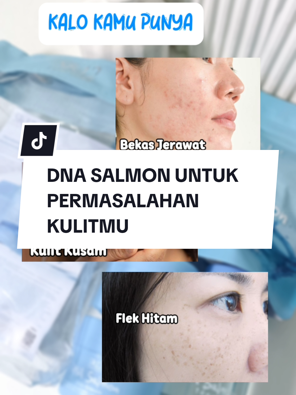 yang punya masalah kulit kusam, flek, bekas Jerawat Ambil #dnasalmon #sr12 #dnasalmonsr12 #flekhitam #kusam #mencerahkan #wibgajian #promoguncang66 
