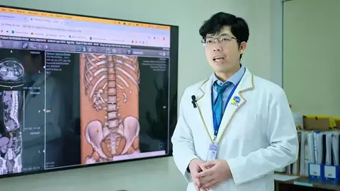 Phỏng vấn bác sĩ trường hợp bệnh nhân sỏi san hô thận. #tietnieu #tietnieunamkhoaxuyenatayninh #tietnieunamkhoabenhvienxuyenatayninh #soithan