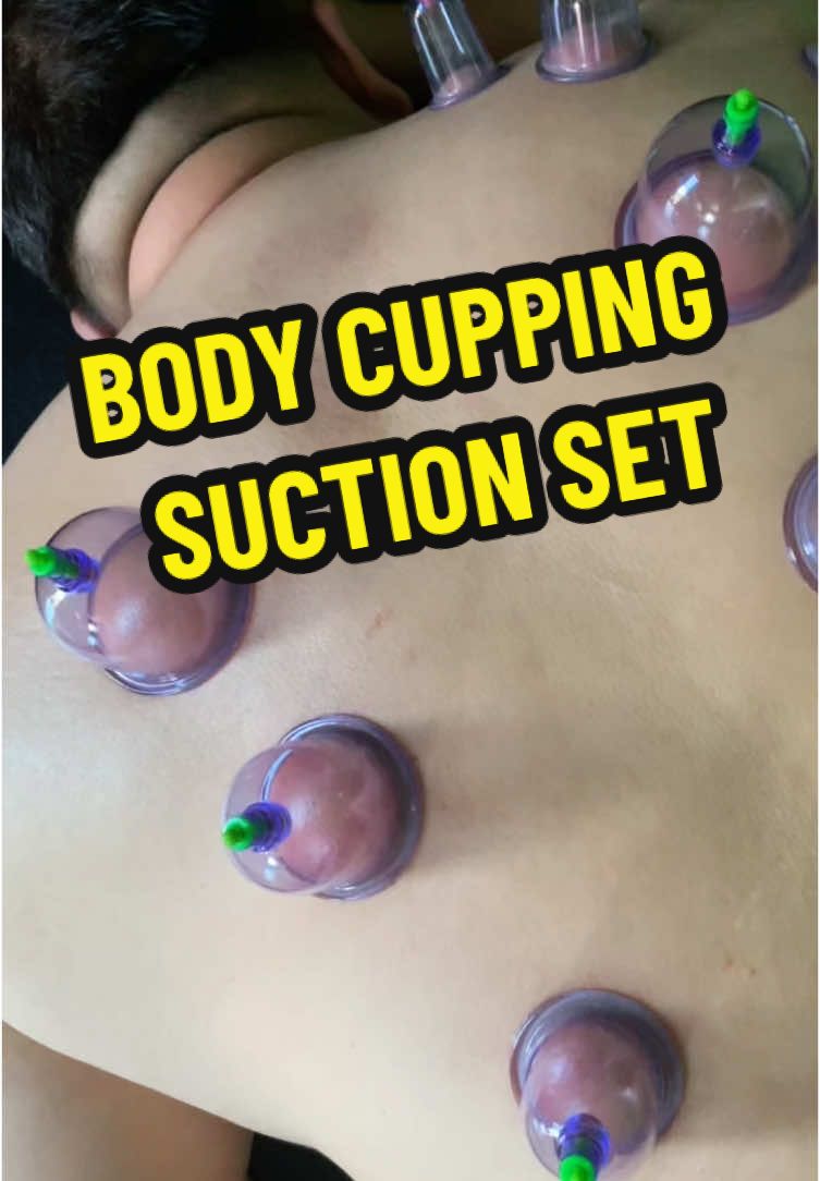 BODY CUPPING SUCTION SET #bodycupping #ventosa  