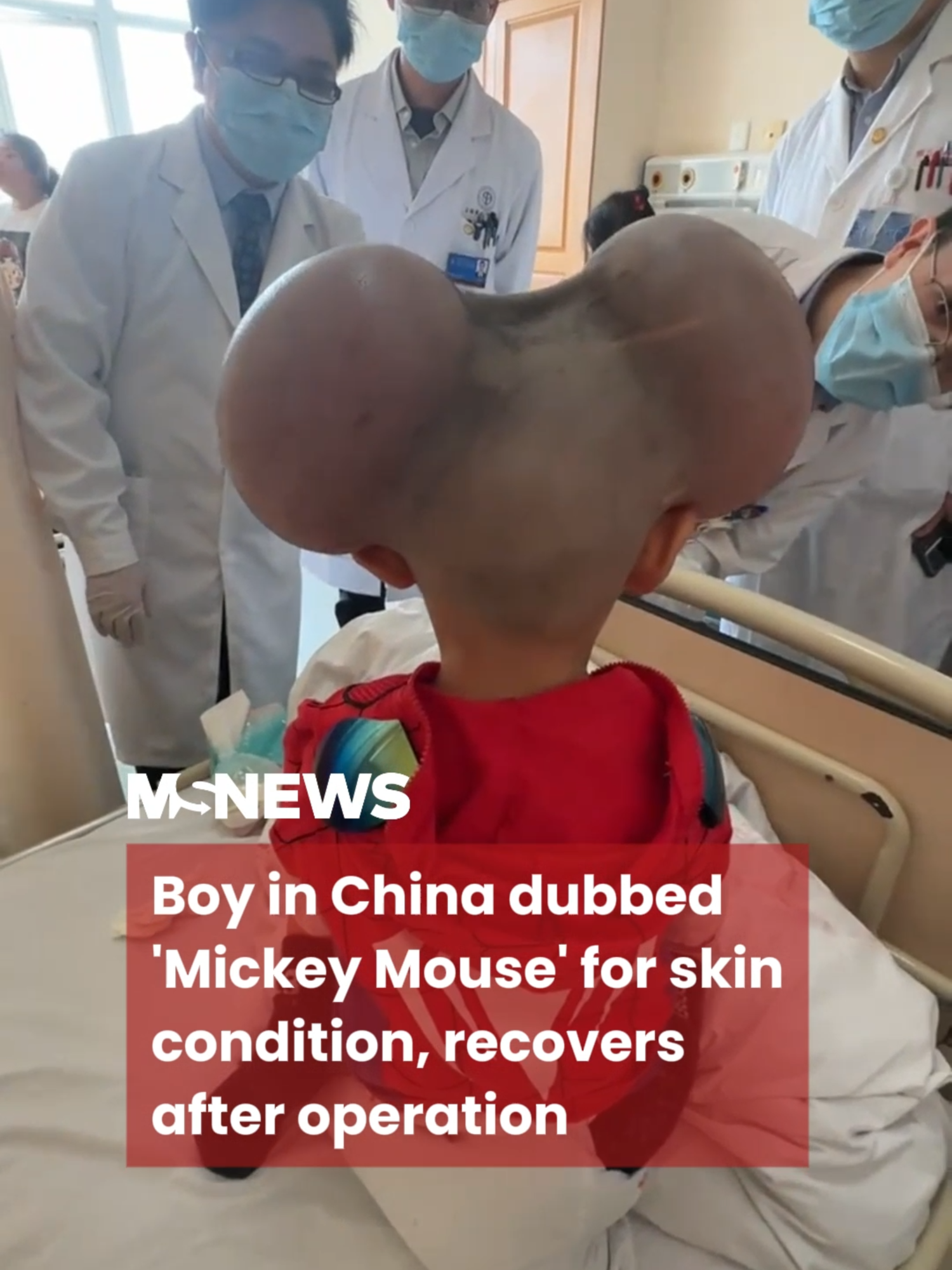 The procedure was successful, and the boy woke up smiling 🌞 #mustsharenews #tiktoksg #fypsg