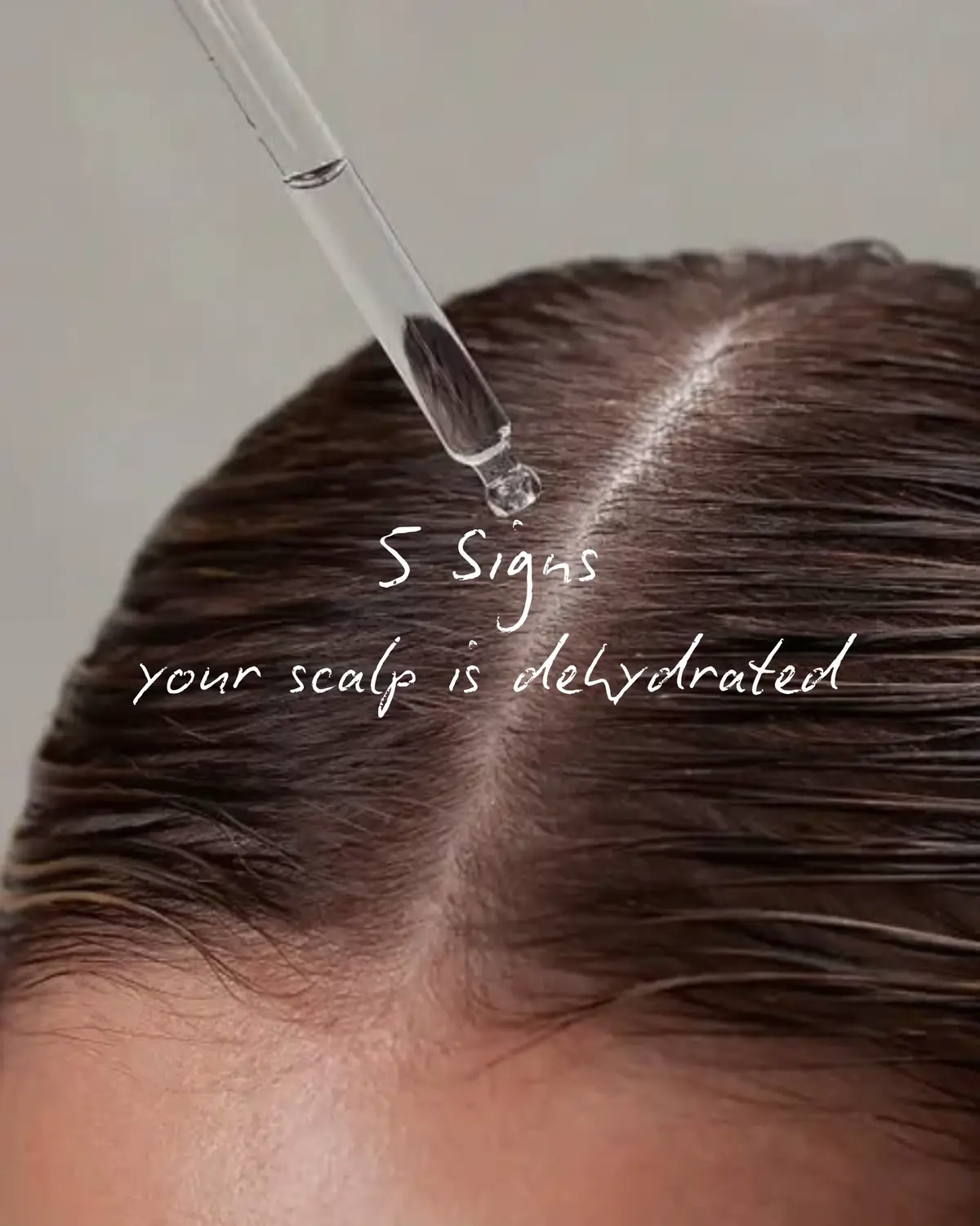 5 SIGNS YOUR SCALP IS DEHYDRATED 💦 Scalp oil is SO important #scalpcare #dehyratedscalp #brokenhair #dandruff 