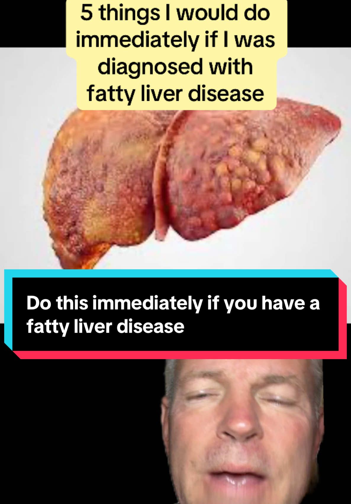 #greenscreen five things I would do immediately if I was diagnosed with fatty liver disease…
