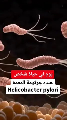 جرثومة المعدة (الملوية البوابية - *H. pylori*) 😷 هي بكتيريا تصيب المعدة وتسبب التهابات، قرح، وحتى سرطان المعدة في الحالات المتقدمة. إليك كل ما تحتاج معرفته عنها:   ### **أعراض الإصابة بجرثومة المعدة** 🤒   - ألم أو حرقان في البطن (خاصة عند الجوع).   - غثيان أو قيء.   - انتفاخ وتجشؤ متكرر.   - فقدان الشهية أو الوزن.   - رائحة الفم الكريهة.   ### **طرق العدوى** 🦠   تنتقل عبر:   - الطعام أو الماء الملوث.   - اللعاب أو الاتصال المباشر مع شخص مصاب.   - الإهمال في النظافة الشخصية.   ### **الوقاية منها** 🛡️   ✅ اغسل يديك جيدًا قبل الأكل وبعده.   ✅ تجنب مشاركة الأواني أو الأكل من طبق شخص مصاب.   ✅ اشرب ماءً نظيفًا وتجنب الأطعمة المكشوفة.   ✅ تناول أطعمة غنية بالبروبيوتيك (الزبادي، الكفير).   ### **العلاج** 💊   يتم تشخيصها عبر **تحليل الدم، البراز، أو التنفس**، والعلاج يشمل:   1. **مضادات حيوية** (مثل كلاريثرومايسين، أموكسيسيلين) لقتل البكتيريا.   2. **أدوية مثبطة للحموضة** (مثل أوميبرازول) لتخفيف الالتهاب.   3. **أدوية حماية جدار المعدة** (مثل بزموث سبساليسيلات).   ### **نصائح غذائية** �   - تجنب الحمضيات، القهوة، والأطعمة الحارة.   - تناول العسل 🍯، الزنجبيل، والثوم (مضادات طبيعية).   - اشرب شاي البابونج ☕ أو النعناع لتهدئة المعدة.   ### **متى تزور الطبيب؟** 🏥   إذا استمرت الأعراض أكثر من أسبوعين أو ظهرت علامات خطيرة مثل:   - قيء دم.   - براز أسود.   - ألم شديد غير محتمل.   العلاج المبكر يمنع المضاعفات! 💪✨   > **تذكير:** لا تهمل الأعراض، جرثومة المعدة قابلة للعلاج لكن إهمالها قد يؤدي لمشاكل مزمنة.#fyp #fyp #f 
