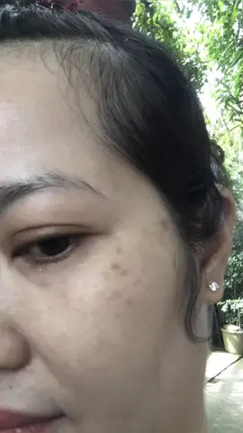 Da mình từng nám – xỉn – sạm, giờ trắng mướt nhờ đúng sản phẩm! Peel da không đáng sợ, sợ nhất là không dám thử! Mình không bán vì lợi nhuận – Mình bán vì da mình đẹp lên từ chính sản phẩm này! DrCell – đáng để tin và trải nghiệm👌 #DrCellChínhHãng   #PeelDaAnToàn   #TinhChấtSâmĐất   #DetoxHồngSâm   #LànDaĐẹpTựNhiên   #DaĐẹpMỗiNgày   #ChămDaCùngMình   #MìnhĐãThửBạnThìSao   #ĐẹpLàPhảiDám   #ChânÁiLànDa