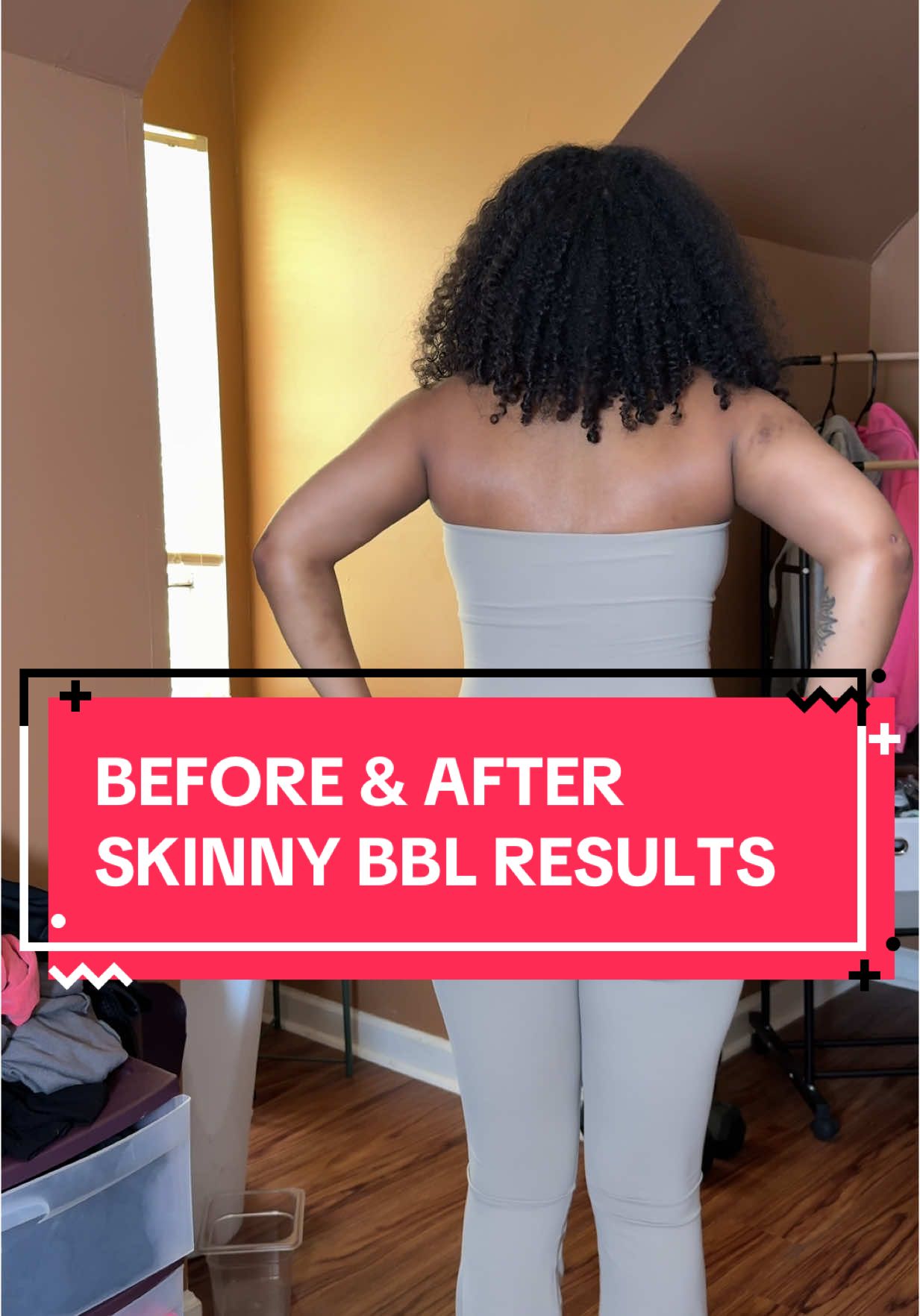 first of all I can’t believe it’s been 4 weeks… secondly I’m so in love with my results so far. It looks like I was born with it 🥰 one of the things I disliked the most was seeing myself from the back in videos. I wanted to be in love with my walk away and now I know I can be. Be mindful we haven’t even fluffed out yet 🥵 #fyp #bbl #bblrecovery #skinnybbl #lipo360 