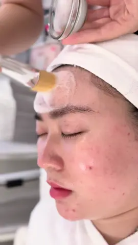 Đã bao lâu rồi bạn bỏ quên làn da của mình ??!                                                    🏠 : Số 135 Trần Quốc Hoàn, Cầu Giấy Hà Nội #trịmụn  #trịmuntham  #trịmunlung  #nặnmụnchuẩnykhoa #chămsócda  #skincare  #beautycenterbytrang #caugiayhanoi #xuhuong #detoxskin #xuhuongtiktok  #detox #luxuryspa #viralvideo #fyp #viraltiktok #viral #làmđẹpcầugiấy #spacầugiấy #trending #nặnmụn_hoàngquốcviệt_cầugiấy  #nặnmụnbằngtay  