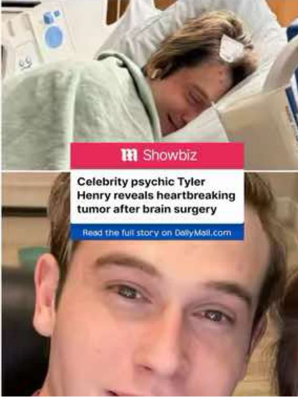 Celebrity psychic medium Tyler Henry has revealed he has successfully undergone brain surgery. The reality star, 29, had most of a 'colloid tumor' removed from his brain and will now be on bedrest for a month. The star announced the operation on Wednesday with a photo of him in his hospital bed, which appeared to have been taken after the surgery. 📷 tylerhenrymedium/IG #tylerhenry #psychic #medium #surgery #news 