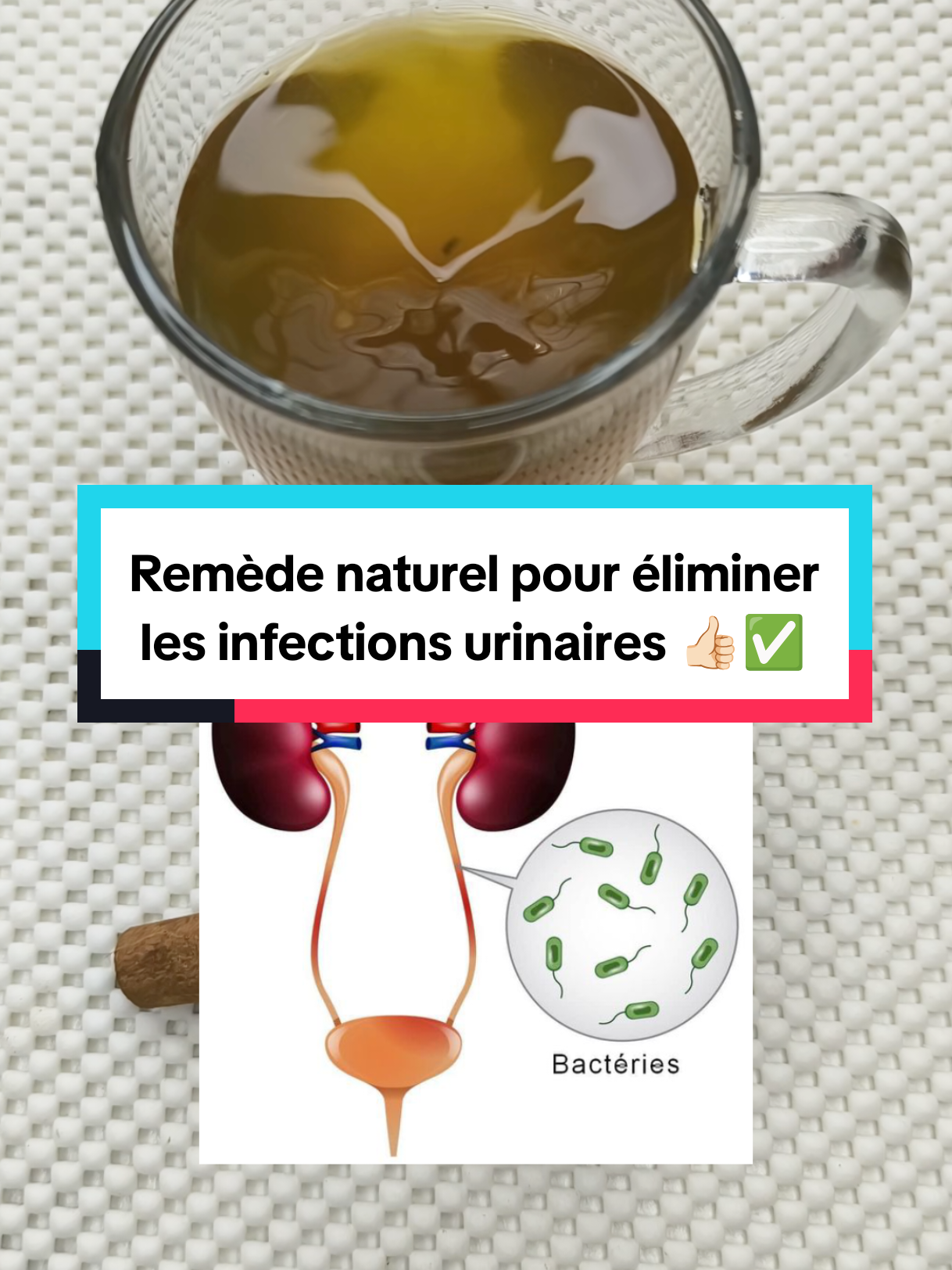 Remède naturel pour éliminer  les infections urinaires  #infectionurinaires #remedenaturel #recettefacile #soisnaturel #france🇫🇷 @SoisNaturel @SoisNaturel 