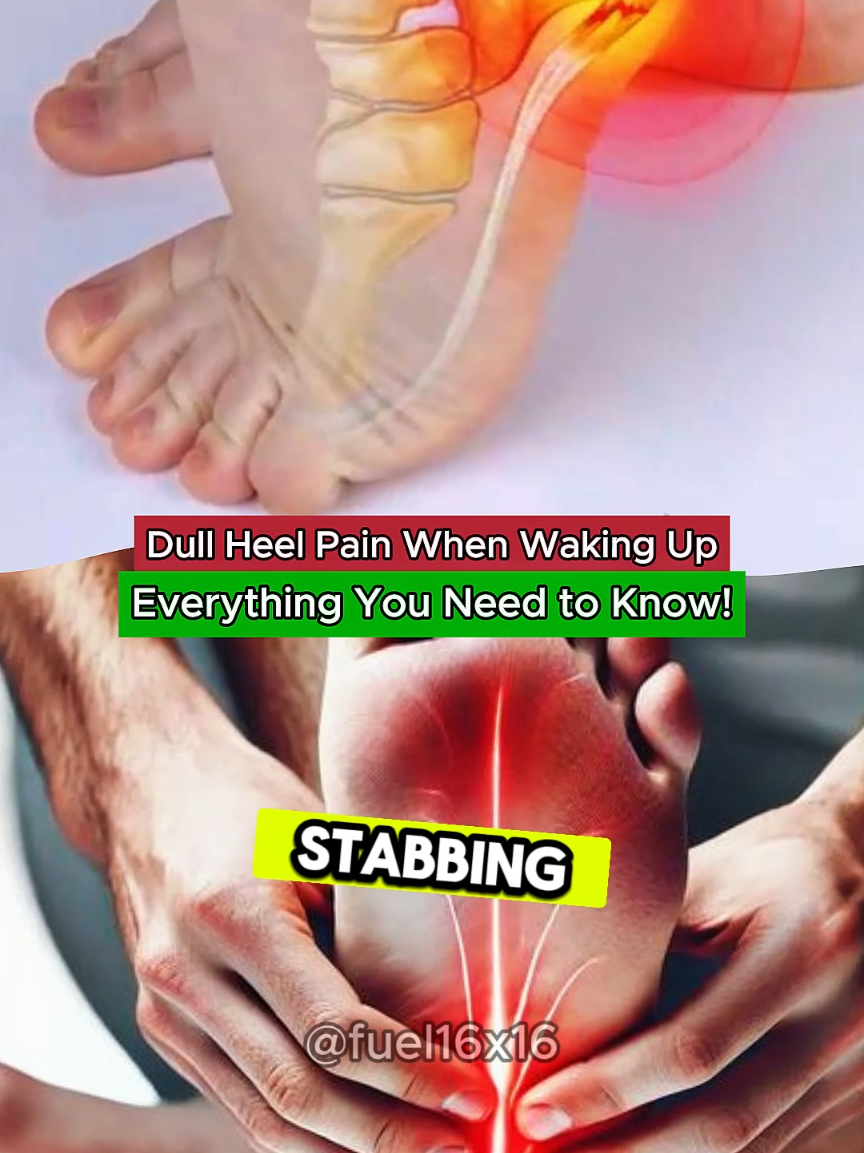 Dull Heel Pain.. #plantarfasciitis  #heel  #causes #symptoms #prevention #medical #healthtips #hospital  #medicine #anatomy #3d