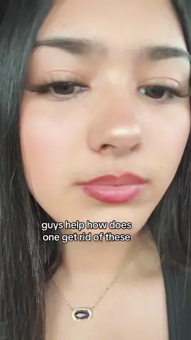 help (edit: yes guys i wash my face pls stop commenting that i don’t😔, i will be investing in a oil cleanser tho) #fyp #viral #acne #pores 