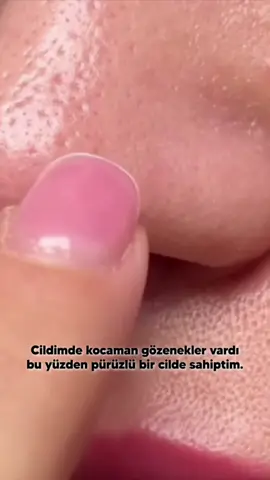 🌿 Cilt lekelerine veda etmeye hazır mısın? Dr. Clinic Leke Kremi ile düzenli kullanımda cilt tonun eşitlenir, lekeler görünümünü azaltır ve cildin aydınlık bir görünüme kavuşur. 💧 Hafif yapısı sayesinde kolayca emilir, cildini yormaz. 🔬 Dermatolojik olarak test edilmiştir. #lekelekremi #ciltbakımı#drclinicc#lekeproblemii#aydınlıkciltt#lekeönleyicii#cilttonueşitleyicii#drclinicc 