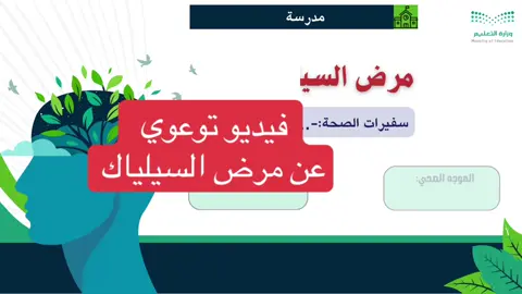 فيديو توعوي عن مرض السيلياك#فديو#توعوي#مرض_السيلياك #التوجيه_الصحي #الموجهة_الصحية #الفصل_الدراسي_الثالث #النشاط_الطلابي #فرح_للخدمات_الالكترونية_والتعليمية #foryou #fypシ゚ 