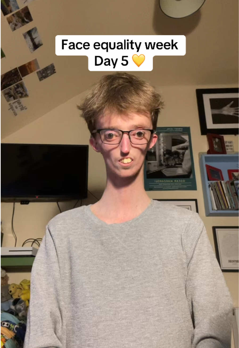 Face equality week - Day 5 💛 We are always to quick to judge and we mostly don’t look at things closely to realise there is something beautiful within. 💛 Remember to be kind and smile and wave to people as they walk by. 💛 #fyp #foryoupagе #trendingnow #relateablecontent #relateable #trends #viralnow #fypsounds #fyppp #getmeontheforyoupage #viral #loveandpositivity #keepsmiling #trendingvideos #trendingsound #dailypost #disabilitytiktok #motivation #faceequality #faceequalityweek #changingfaces #visibledifference #sharethevideo #motivationalspeech #inspiration #inspireothers #youareenough 