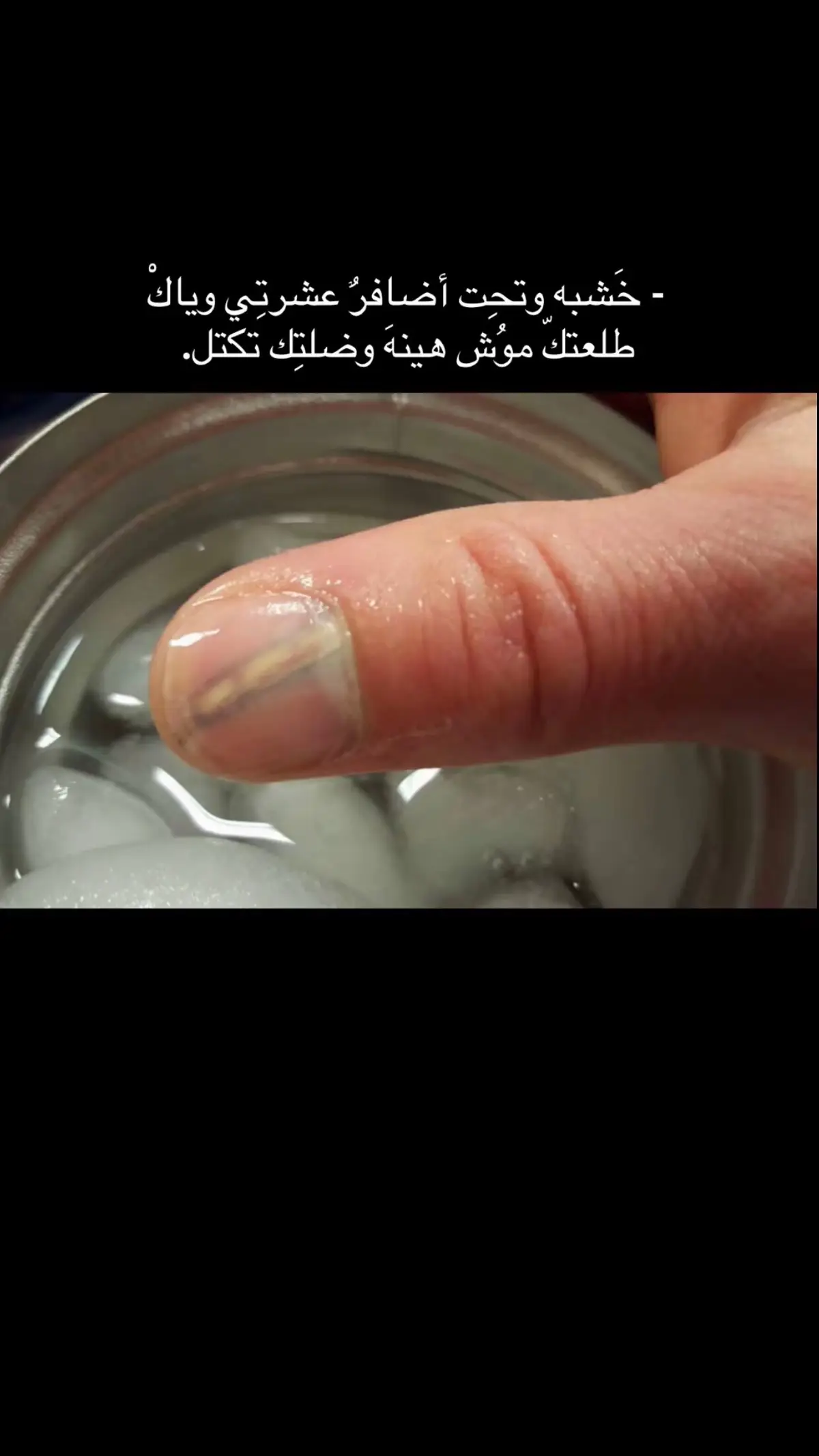 #الشعر_الشعبي_ذواقين_الشعر_الشعبي #شطر #viral 