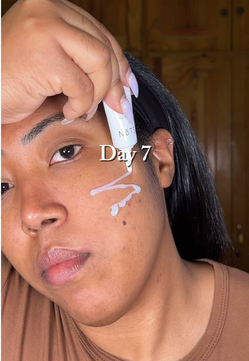 I started testing this product with Centella Asiatica. I didn't expect miracles, just something to soothe my skin a little bit. I applied it for 8 days with patience and hope. There were moments when my skin did not react as I wanted... I even felt a little frustrated. But I kept going anyway, taking loving care of it and using the Centellascars Ointment by @NOTS USA with a lot of enthusiasm. ✨ The end result looks good on camera, but more than that, it was a reminder that my skin has its own rhythm, and that's okay too. Thanks to you, if you're reading this, for walking me through this process as real as any skin 💛 #SkinJournal #CentellaAsiatica #SkincareReal #SkinWithHistory #KBeautyJourney #SkinInProcess #NotsSkincare #CentellascarsOintment #SkincareReview #CentellaAsiatica #KBeautyEnglish #SkinRoutine #SkincareHonest #KoreanFacialCare #RealSkin #SkincareDiary #SkincareJournal #SkinJournal #fyp 