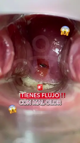 Cuida tu salud íntima con un examen sencillo pero esencial 💖 En Obstetric Care, el examen de flujo vaginal permite detectar infecciones, desequilibrios y prevenir complicaciones mayores ‼️ ➡️Rápido, confiable y con el acompañamiento de especialistas que te hacen sentir segura. Si quieres más información sobre este procedimiento comenta FLUJO 🫰🏻 #obstetricia #mujeres #educacionsexual #salud #hombres #medicina #responsabilidad #sèxual #fypp #paratii 
