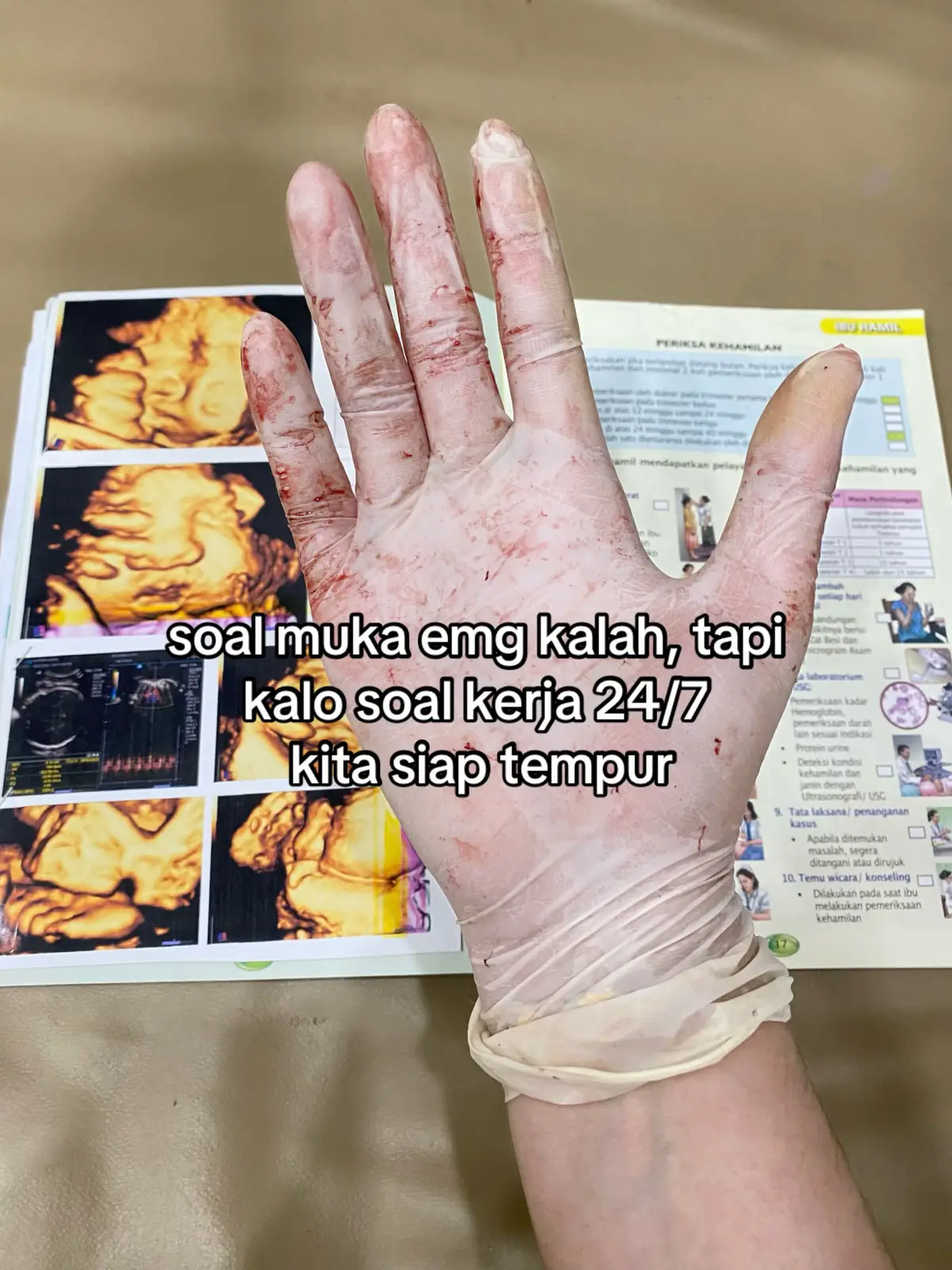 andaikan partus datang lgsg brojol kita juga seneng😣