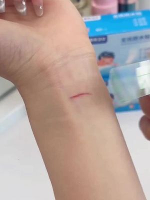 Đôi khi không tránh khỏi va chạm nhỏ, nên chuẩn bị nhiều miếng dán chống thấm, tiện lợi.517yf311
