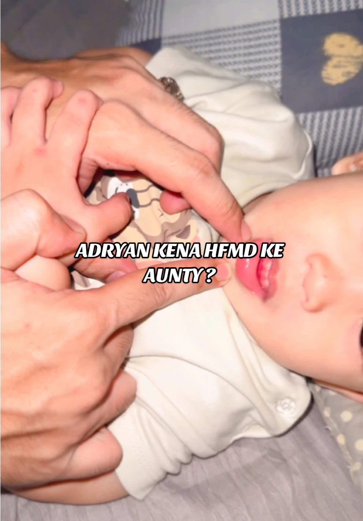 betul ko hfmd kalu gitu ? 3hari doh dio xsey v sentuh mulut dy mybe sbb sakit 🥹 @𝑴𝒖𝒎𝒎𝒚𝒌𝒊𝒏𝑩𝒆𝒂𝒖𝒕𝒚🫦 @pokbeyyy_02 #fypシ 