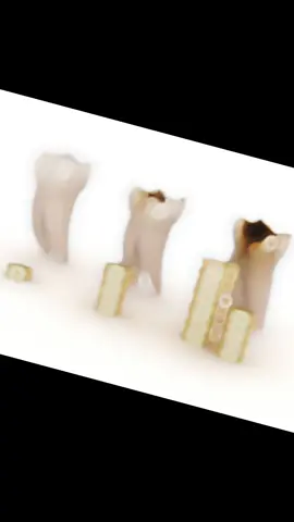 تهلى في سنانك دوك قبل ما تخرج بزاف دراهم مبعد ... معالجة الأسنان ليست باهضة الثمن، لكن الإهمال هو ما يجعلها كذلك.  تنظيف يومي للأسنان + زيارة دورية روتينية  لطبيب الاسنان من 6 أشهر ألى سنة تساهم في الحفاظ على صحة أسنانكم و جيوبكم.