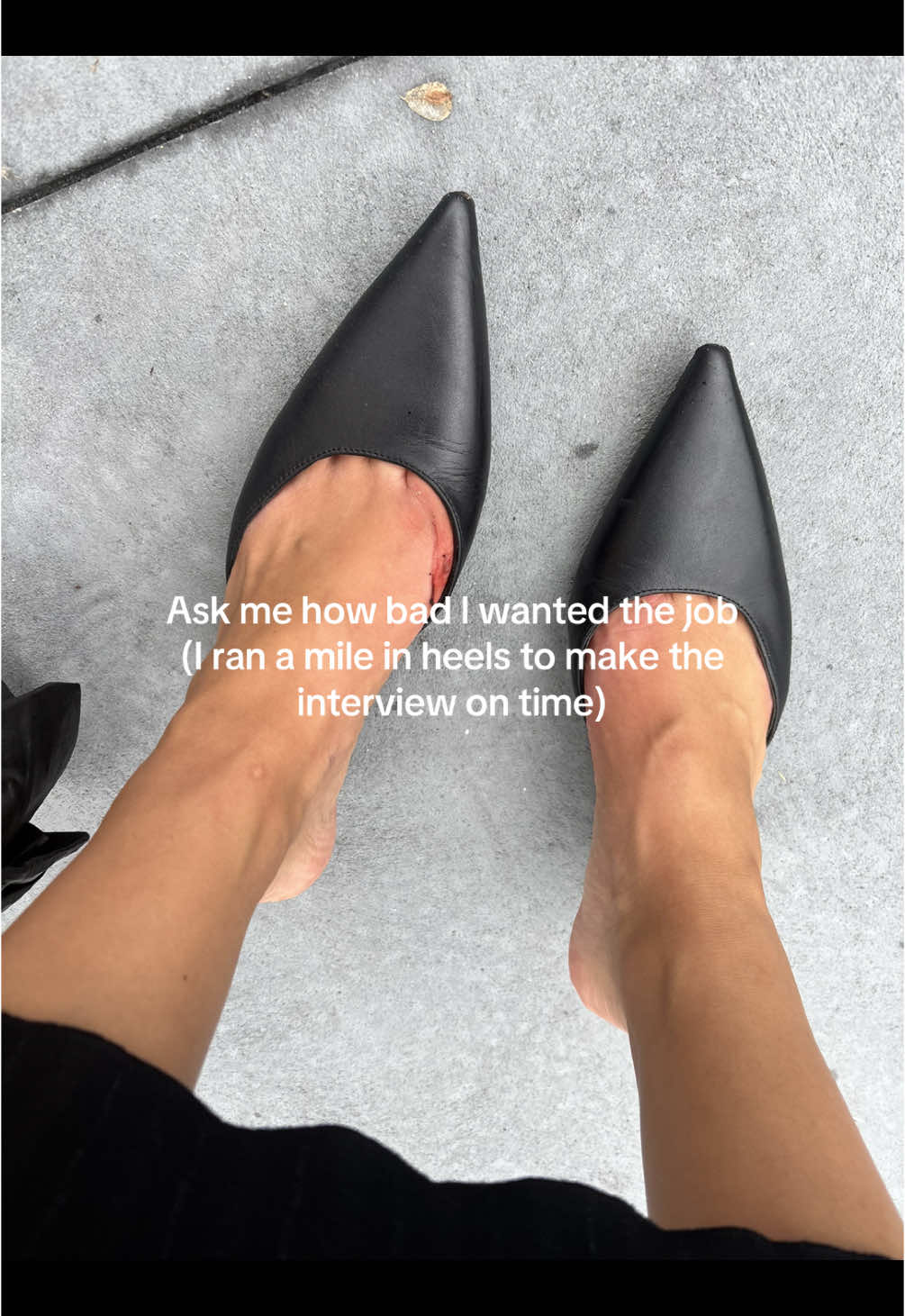 I’ve been limping all day 