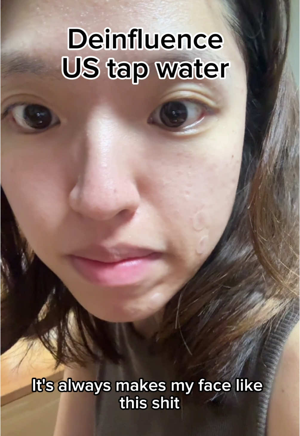 Face sebderm go worse to me cuz tap water i guess my derm says i should use water filter whatever #facesebderm #tapwater #skincare #acneprone 