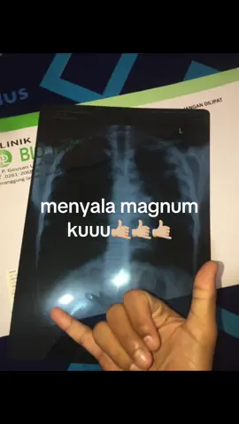 paru paru magnum wkwkwk #masukkkberandaaa #fyppppppppppppppppppppppp #nosmokinng #abcxyz #gaz #cowonyalse🤙