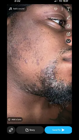 Fellas, don’t sleep on turmeric soap 💪🏾 Clears up acne, razor bumps, and pimples — plus it keeps your skin smooth and glowing. Real men take care of their skin too. 🧼🔥 #TurmericSoap #MensSkincare #RazorBumpFix #ClearSkinForMen #GroomingRoutine #AcneSolution #GlowUpForGuys #SkincareGameStrong #NaturalSoap #HealthySkinGoals