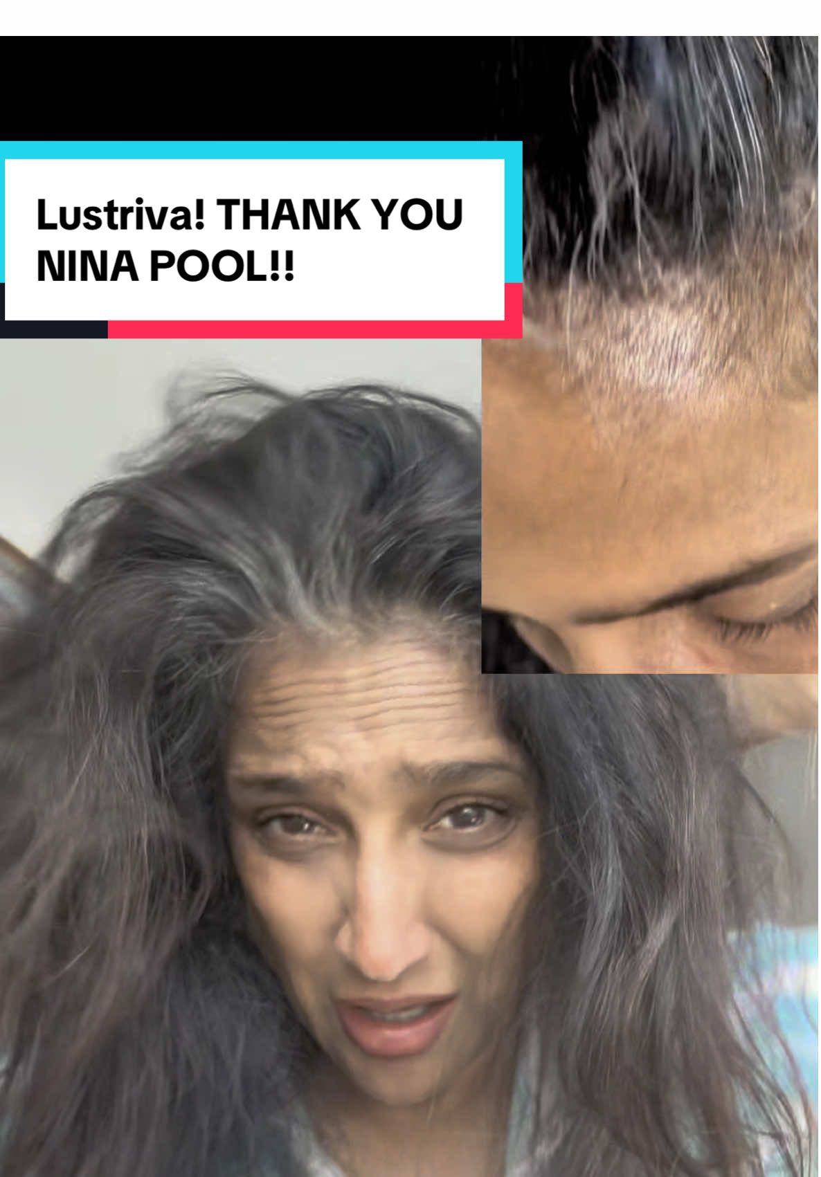 #creatorsearchinsights @Force Factor Unlock Your Hair's Potential with Supplements. Thank you Nina pool!!! #hairsupplements #hairhack  #healthylifestyle #hairgrowth #haircare #wellness  #forcefactorhairgrowth #Lustriva #HairGrowthJourney #resultsmayvary  #ViralHairHack #ThickerHairFast #HairTok #ForceFactor