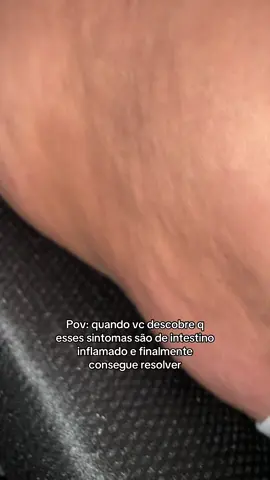 amigas que se identificam, comentem aqui 🥹 #inchaço #estomagoalto #secabarriga #retencaodeliquido 