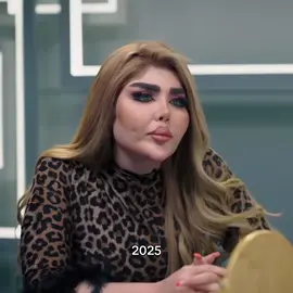 She was so pretty:( زينة عماد العراقية قبل التجميل #beauty #women #surgery #iraq