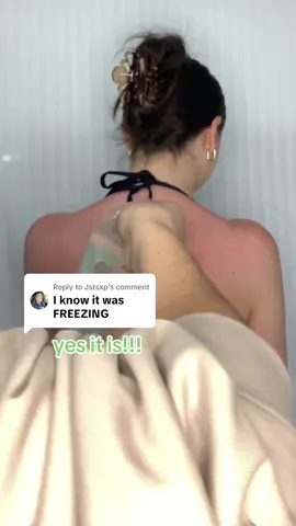 Replying to @Jstsxp indeed it is!!! #termaburn #sunburnrelief #cold 