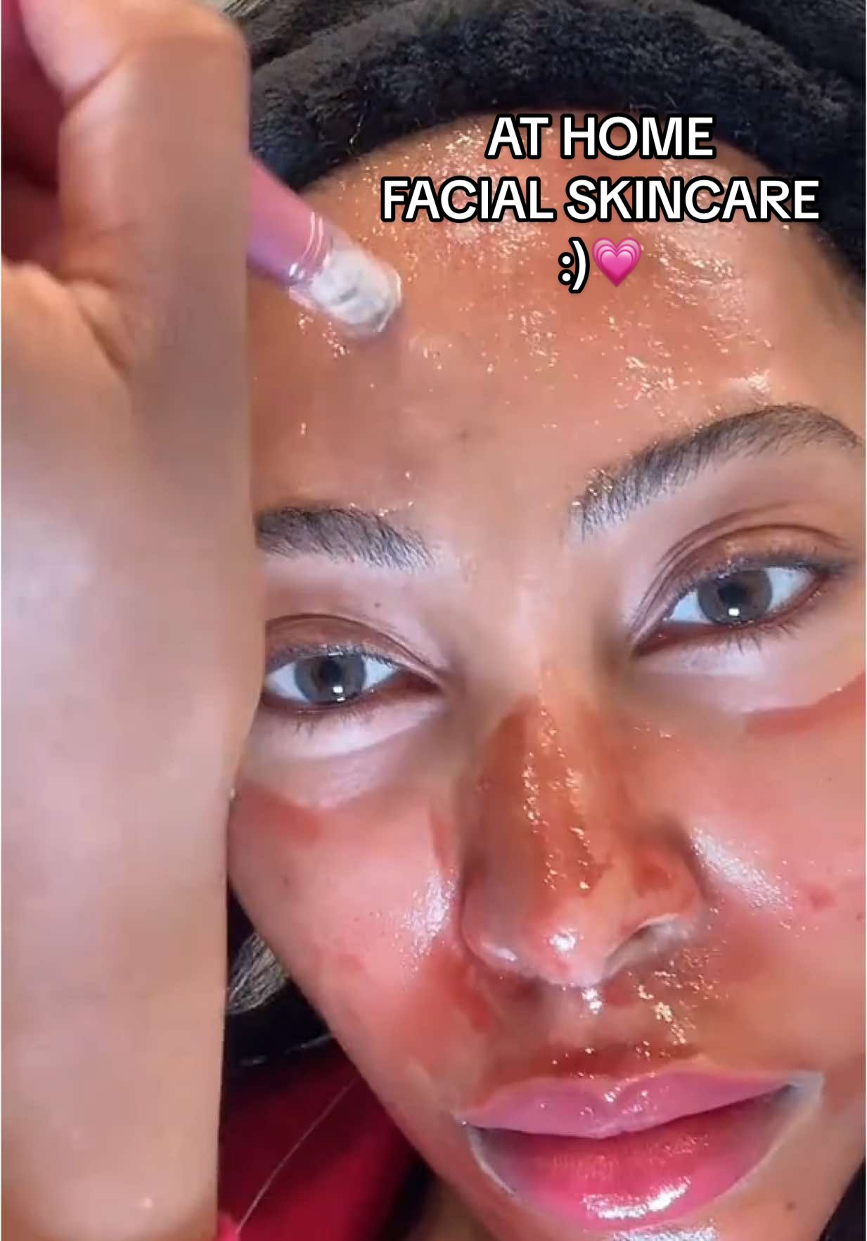 At home facial skincare :) 💗 microneedling and peel!  Products used:  The Ordinary AHA BHA Solution Pelcas Microneedling Device BRÜUN SD - Control Salmon DNA Ampoule Abib Collagen Eye Cream Medicube Red Peeling Pads  Acwell Licorice Toner Anua Rice Serum Topicals Faded Cream Heimish Moringa Ceramide Hyaluronic Cream Disclaimer: I am a licensed esthetician that knows what I’m doing 💗 #fyp #microneedling #microneedingdemo #salmondna #facial #athomefacial #skincare #koreanskincare #brownskin #blackgirl #licencedesthetician #hyperpigmentation #theordinarypeelingsolution #anua #medicube 
