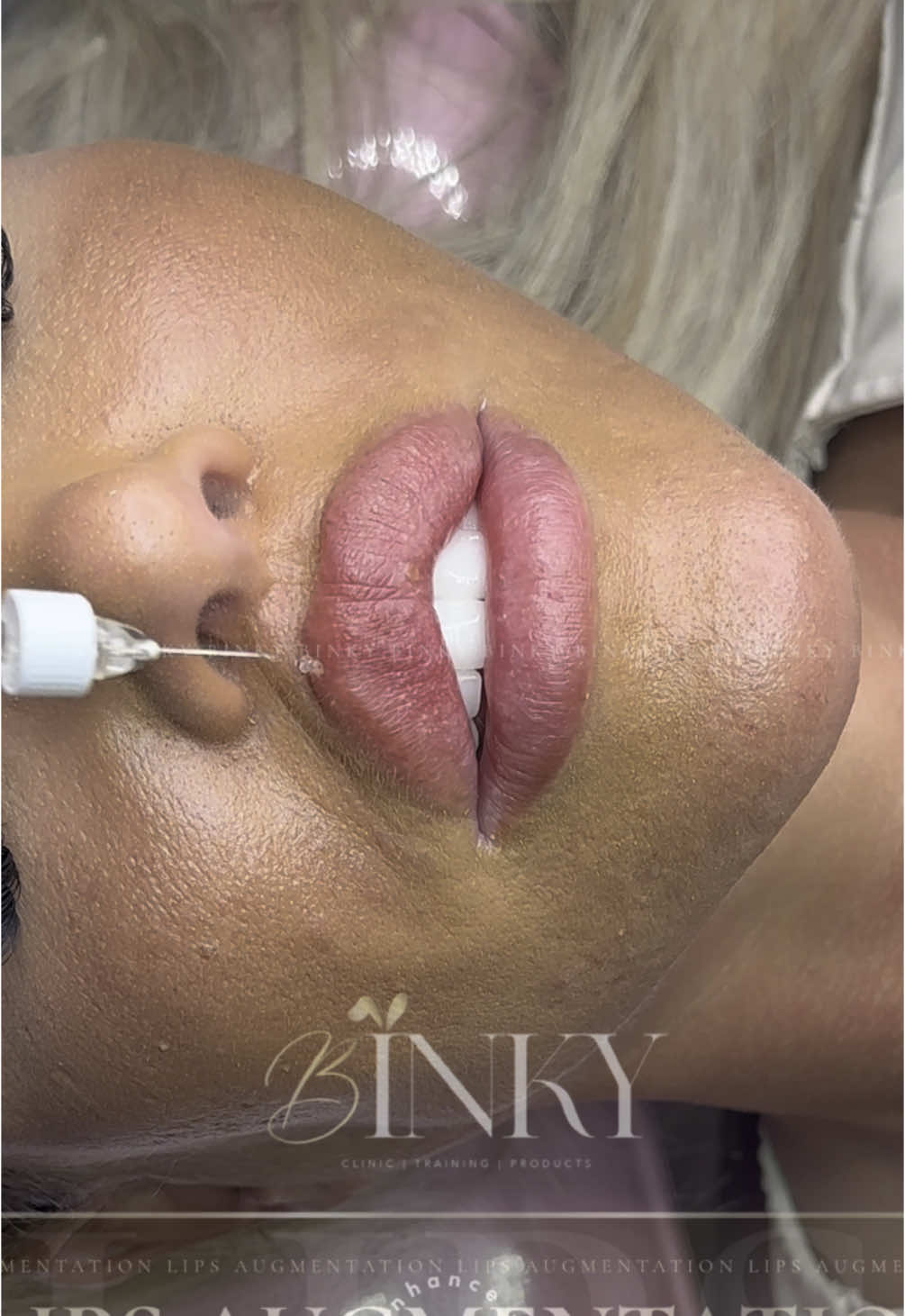 #CapCut #lips #russianlips #russianlipstraining #binkylips #russianlipstechnique #cosmetology #contourlips #londonlips #heartlips 