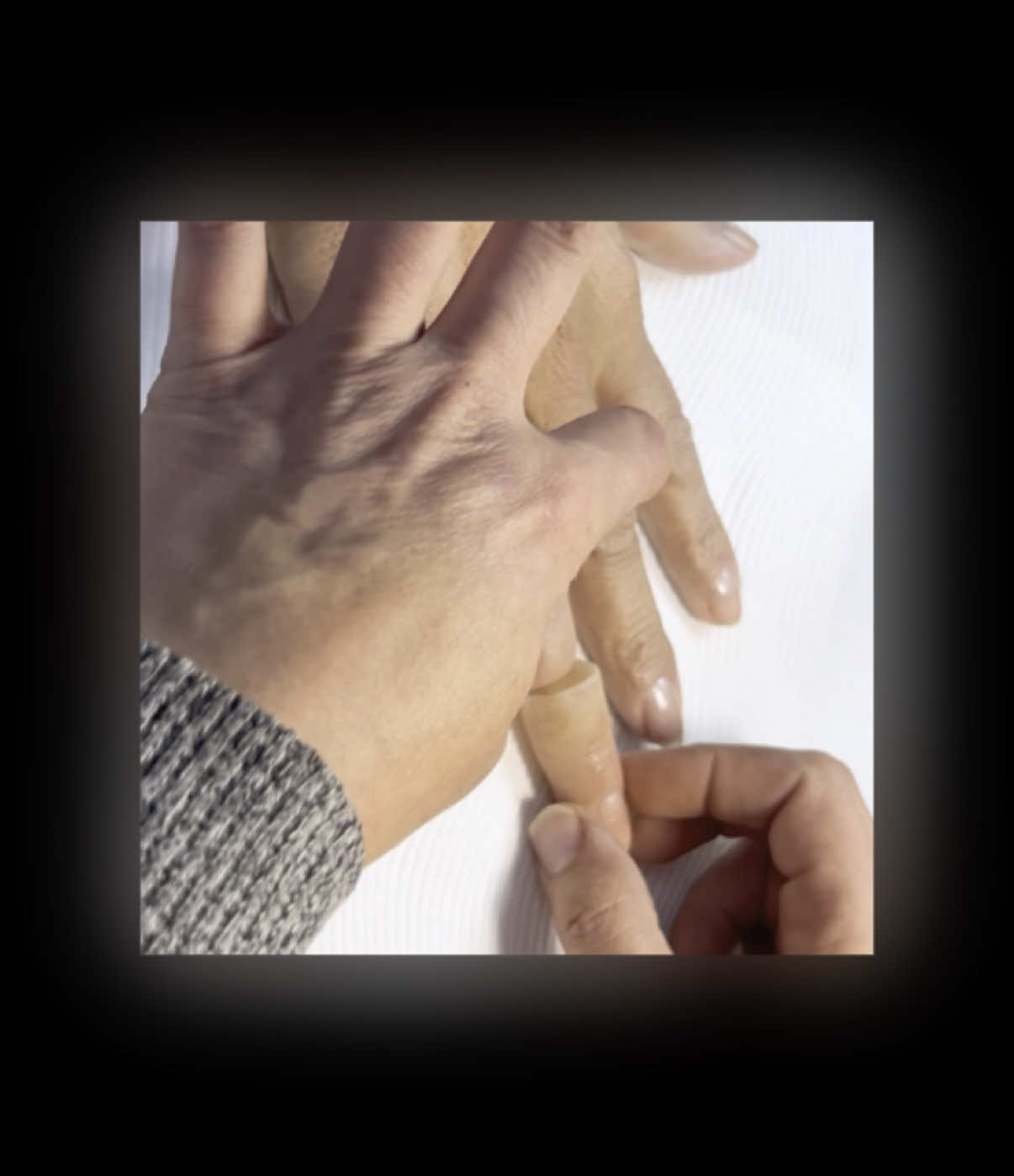 A custom realistic prosthetic finger I created for an amputee. #anaplastologist #sorreal #ginacohencca #finger #amputee #prosthesis #nailtok #acrylic #silicone