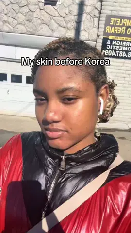 The power of K Beauty. I definitely still deal with acne but it’s on and off. If you know you know.  #seoul #seoullife #seoulkorea #seoultrip #foreignerinkorea #foreignerlivinginkorea #skincaretips #haitianinkorea #kbeauty #korea #lifeinkorea #seoulbeauty #koreaglowup #seoulbeauty #beautylifestyle #skincarejunkie #glowinskincareroutine #glassskin 