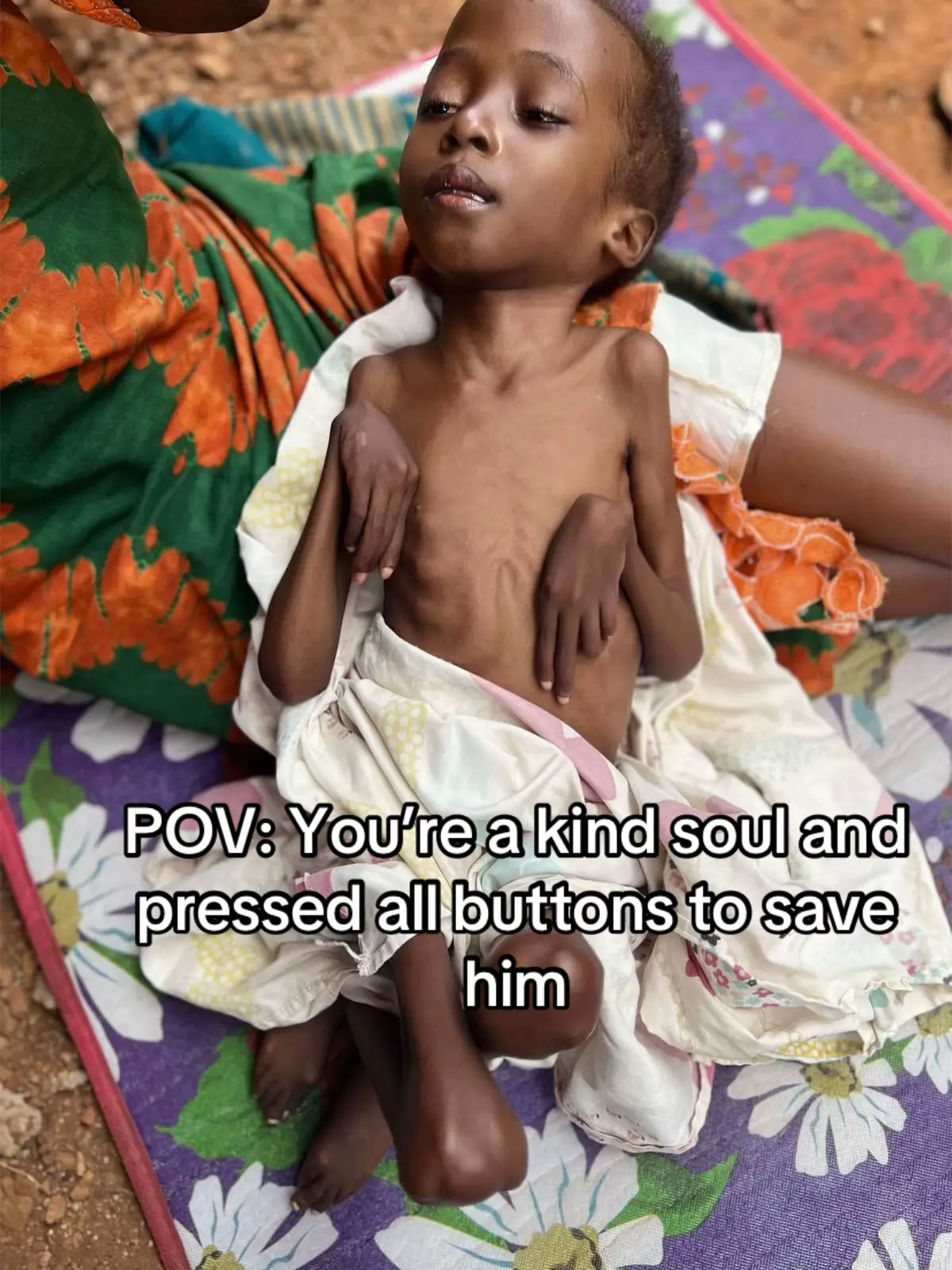 Even $1 helps and means a a lot to save him #courageoushearts #babiesoftiktok #baby 