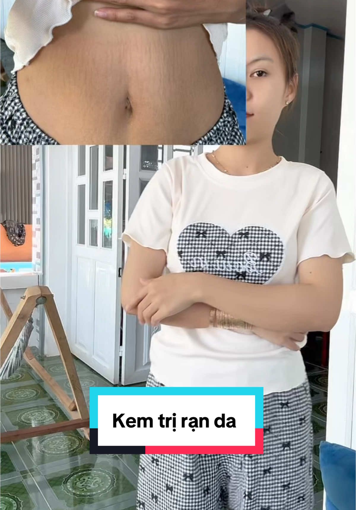 Mới Sài 2 tuần thấy giảm mừng ơi là mừng #mebimsua #mebimreview #kemranda #kemtriranda  @Ngọc Hân {Mẹ Bé Bơ}  @Ngọc Hân {Mẹ Bé Bơ}  @Ngọc Hân {Mẹ Bé Bơ} 