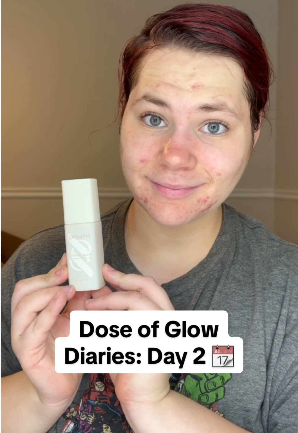 Day 2 of my glow-up using @prosera Dose of Glow Serum 💧  My skin’s still calming down from my facial, but the hydration is already showing up✨ Let’s see where this takes me in 14 days! #proseraskin #doseofglow #14dayglowchallenge #skincarejourney #tiktokshopfinds #glassskingoals #acnescars #hydratedskin #summerglow #BeautyTok #glowingskin #skincareroutine #dewyskin #skincaretok #beforeandafter #vitamincserum #niacinamide #skincareroutinecheck #clearskinjourney #tiktokmademebuyit #skincareproducts #skingoals #skincarecommunity #acnescarremoval