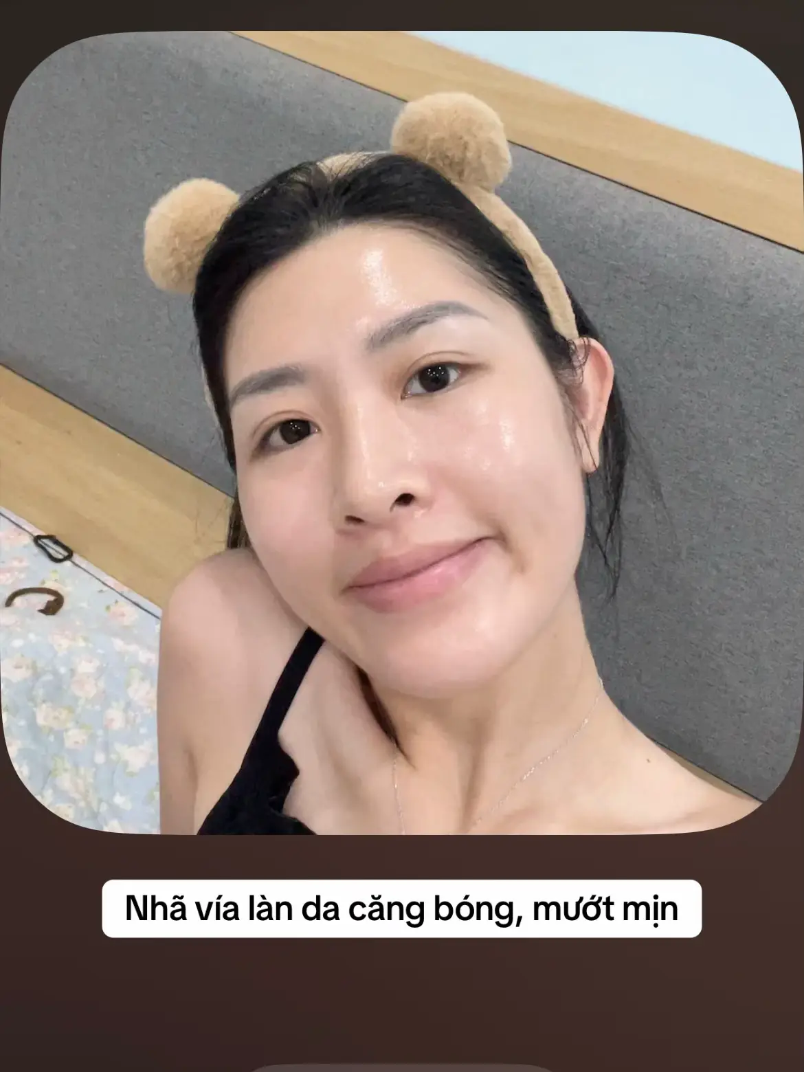 Không cần quá trắng chỉ cần không có mụn thâm là được rồi #fyp #chamsocda #duongda #lamdep 