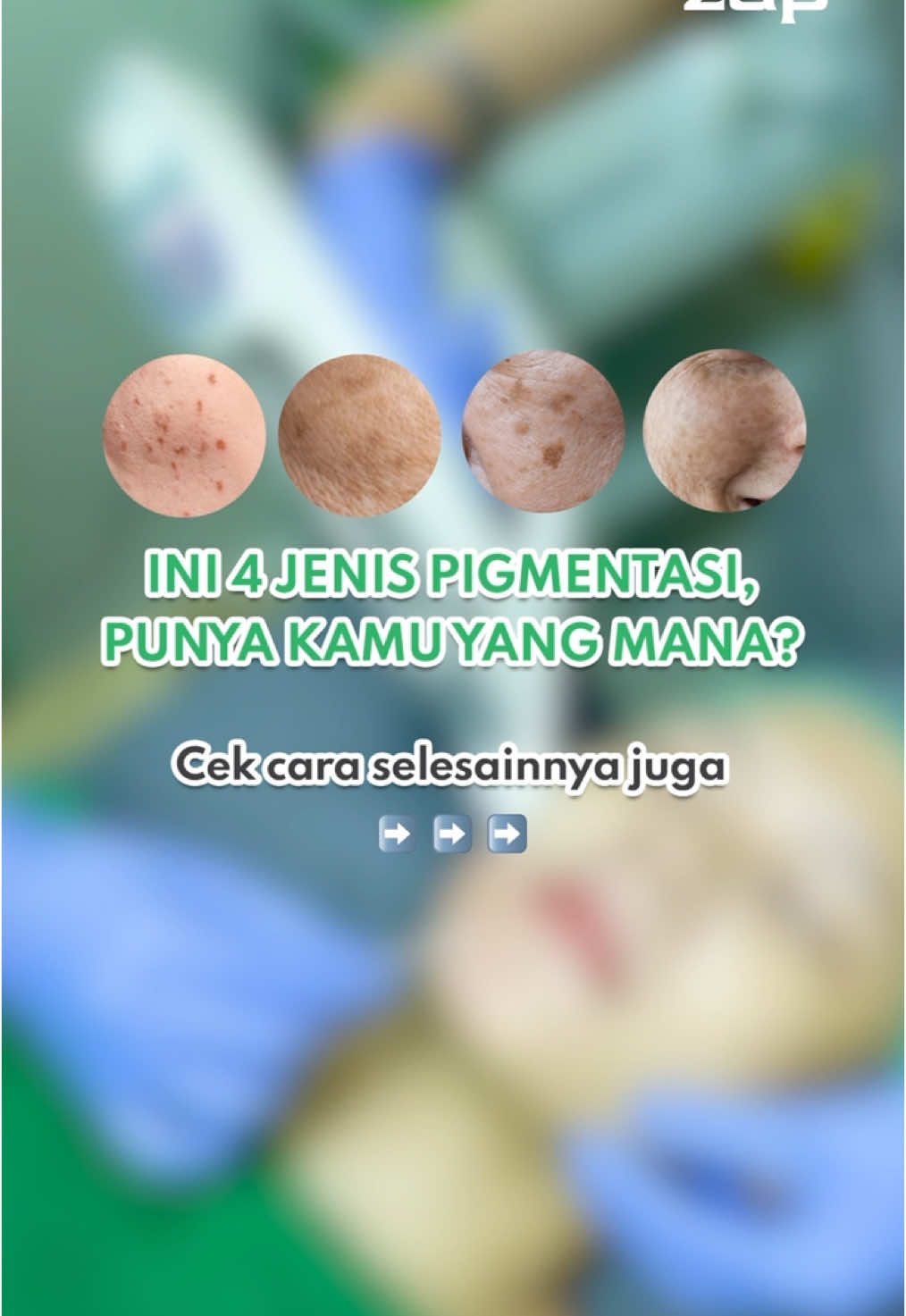 Cari tau lebih dalam soal pigmentasi yang kamu milikin yuk, biar tau cara nyelesainnya gimana➡️ #zap #zapclinic #SemuaBisadiZAP #PerawatanSampaiCantikNoMakeUp 