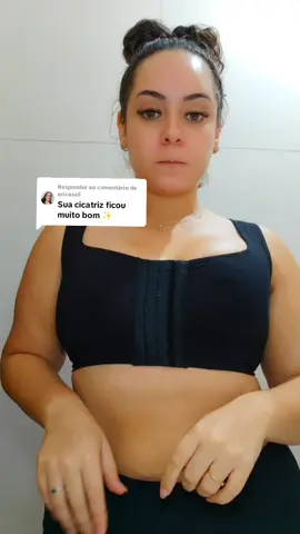 Respondendo a @ericassil  sobre a cicatriz.. #mastopexia #cirurgia #mamoplastiaredutora #mamoplastia #protese #posoperatorio #poscirurgico #maxtopexia 