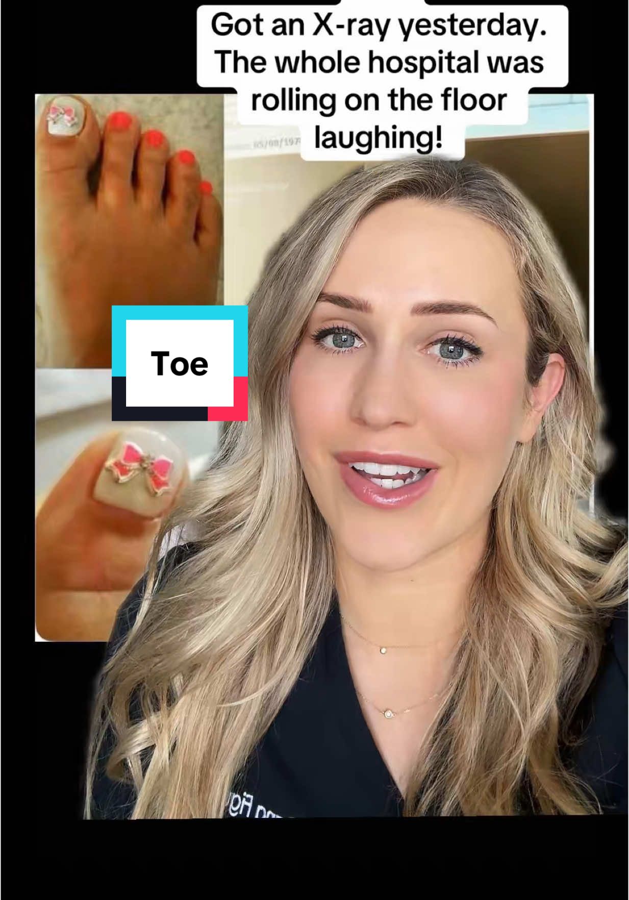 Too cute 😆  VC: @𝐸𝑚𝑧♡︎  #xray #foothealth #imaging  